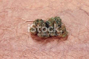 Blue Dream Marijuana on a Copper Background